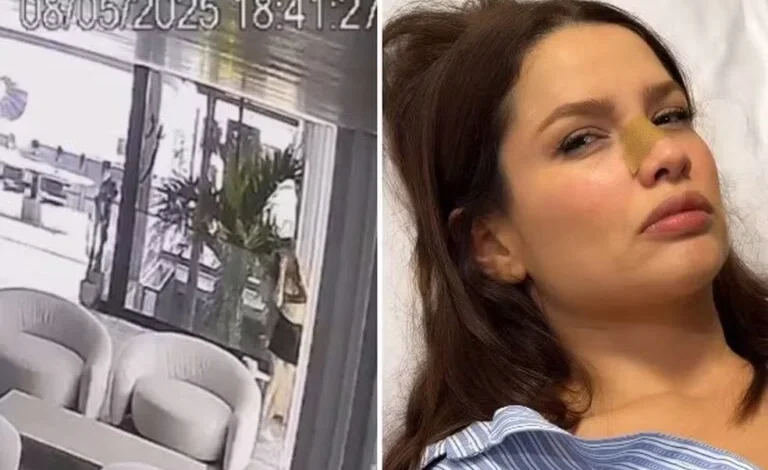 Juliette bate o rosto em porta de vidro e fratura o nariz